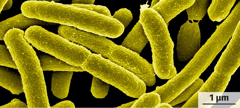 E. coli en microscopie électronique à balayage