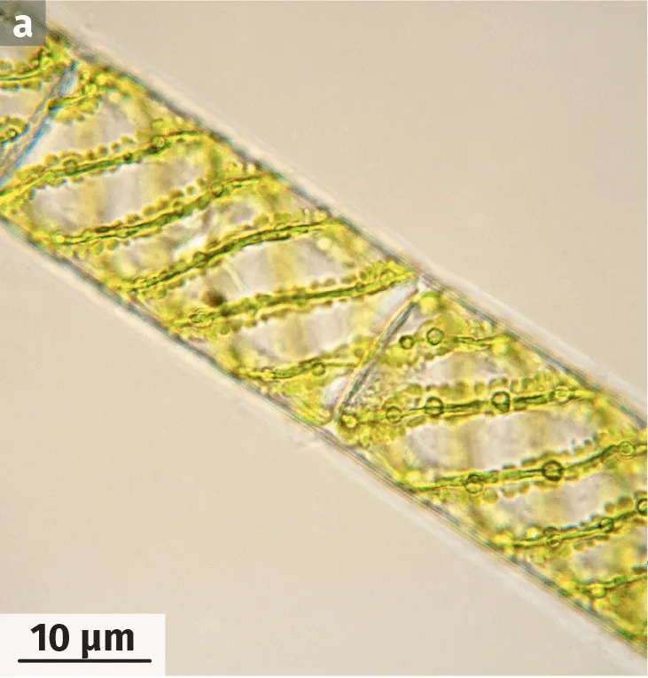 Photographie d'un filament de spirogyre