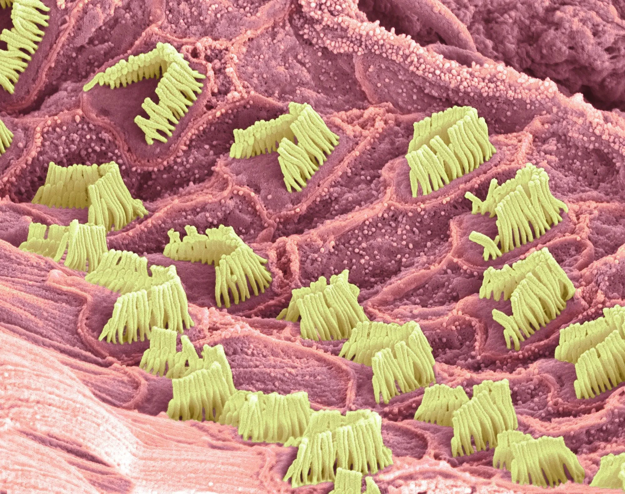 Photographie des cils vibratiles
des cellules ciliées (MEB)