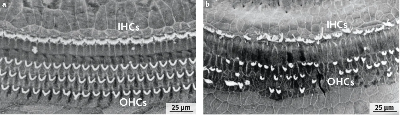 Photographies de la membrane sensorielle de la cochlée avant et après un traumatisme sonore (MEB)