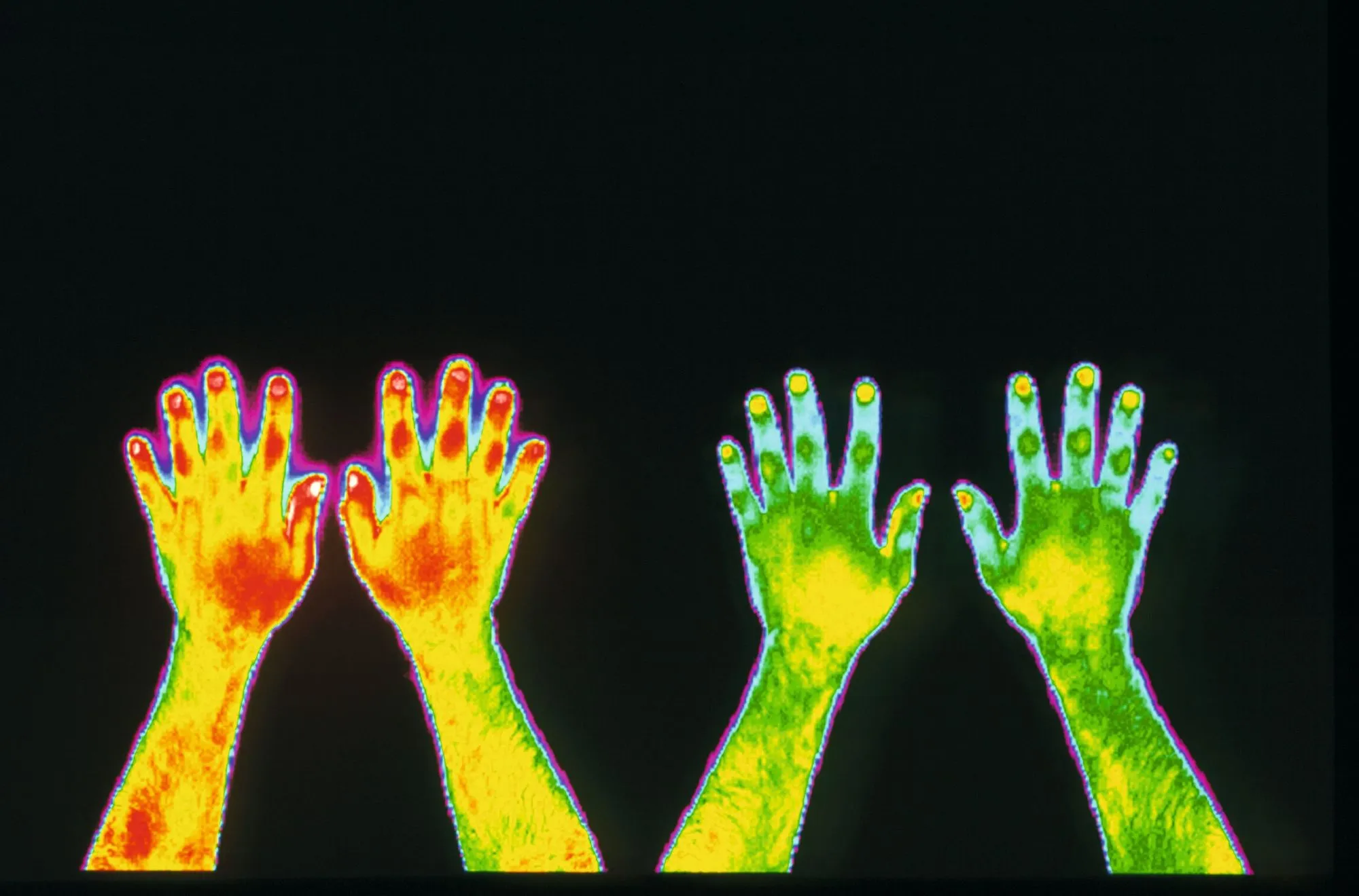 Imagerie infrarouge des mains d'un fumeur