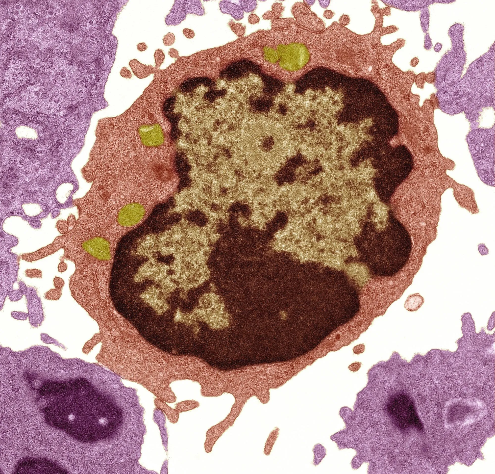 Lymphocyte B (globule blanc).