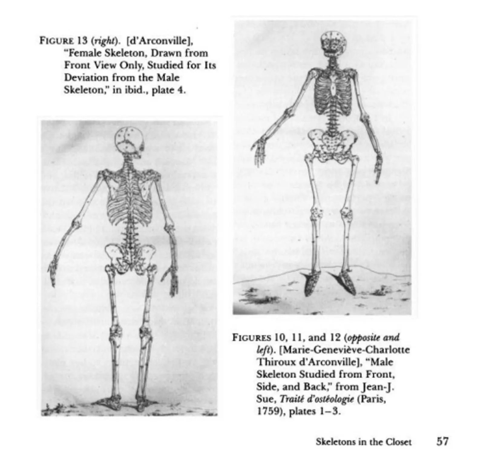 Squelette d'Arconville