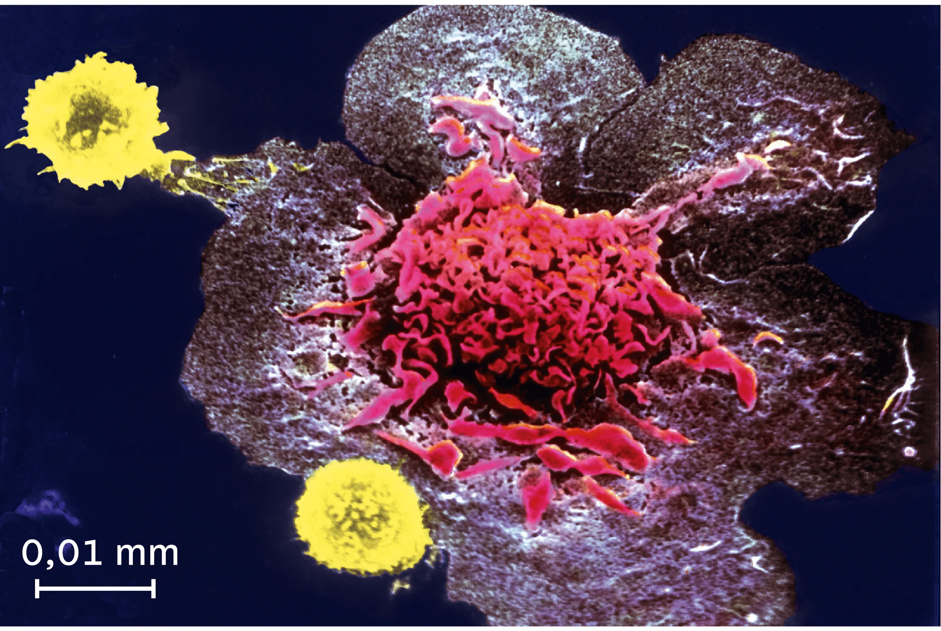 <stamp theme='svt-green1'>Doc. 3</stamp> La destruction d'une cellule infectée par des lymphocytes T observée au microscope électronique à balayage (image colorisée).