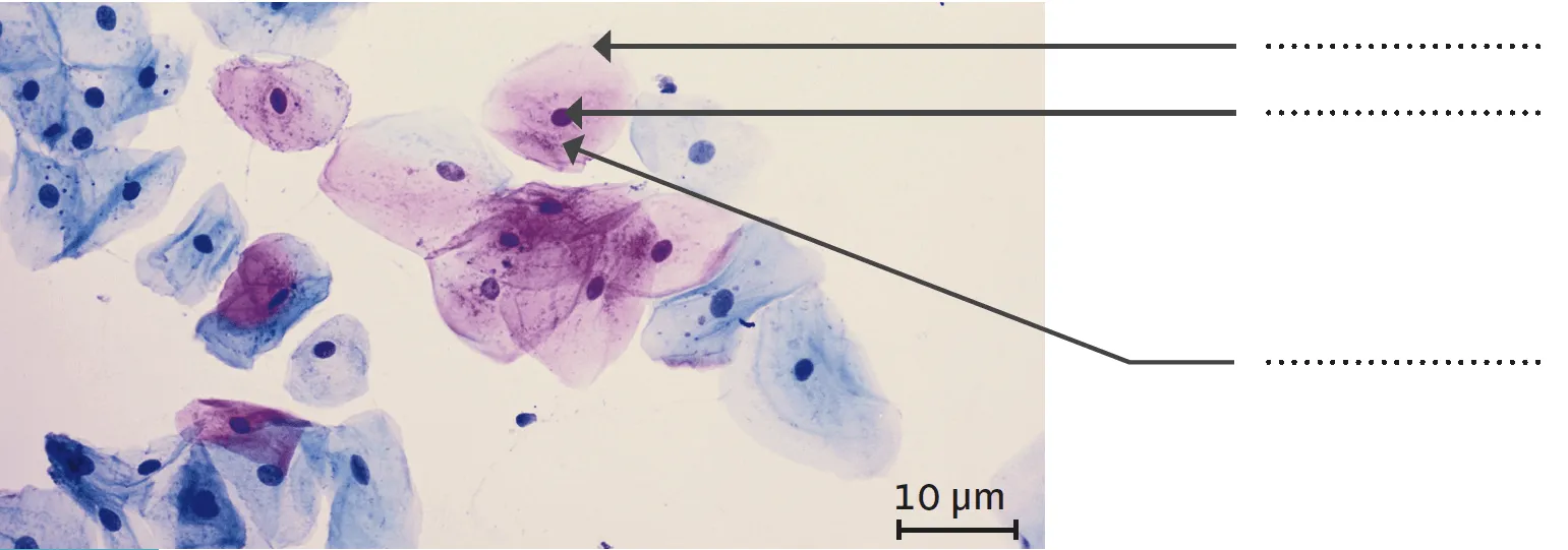 Observation microscopique de cellules prélevées dans le col de l'utérus
