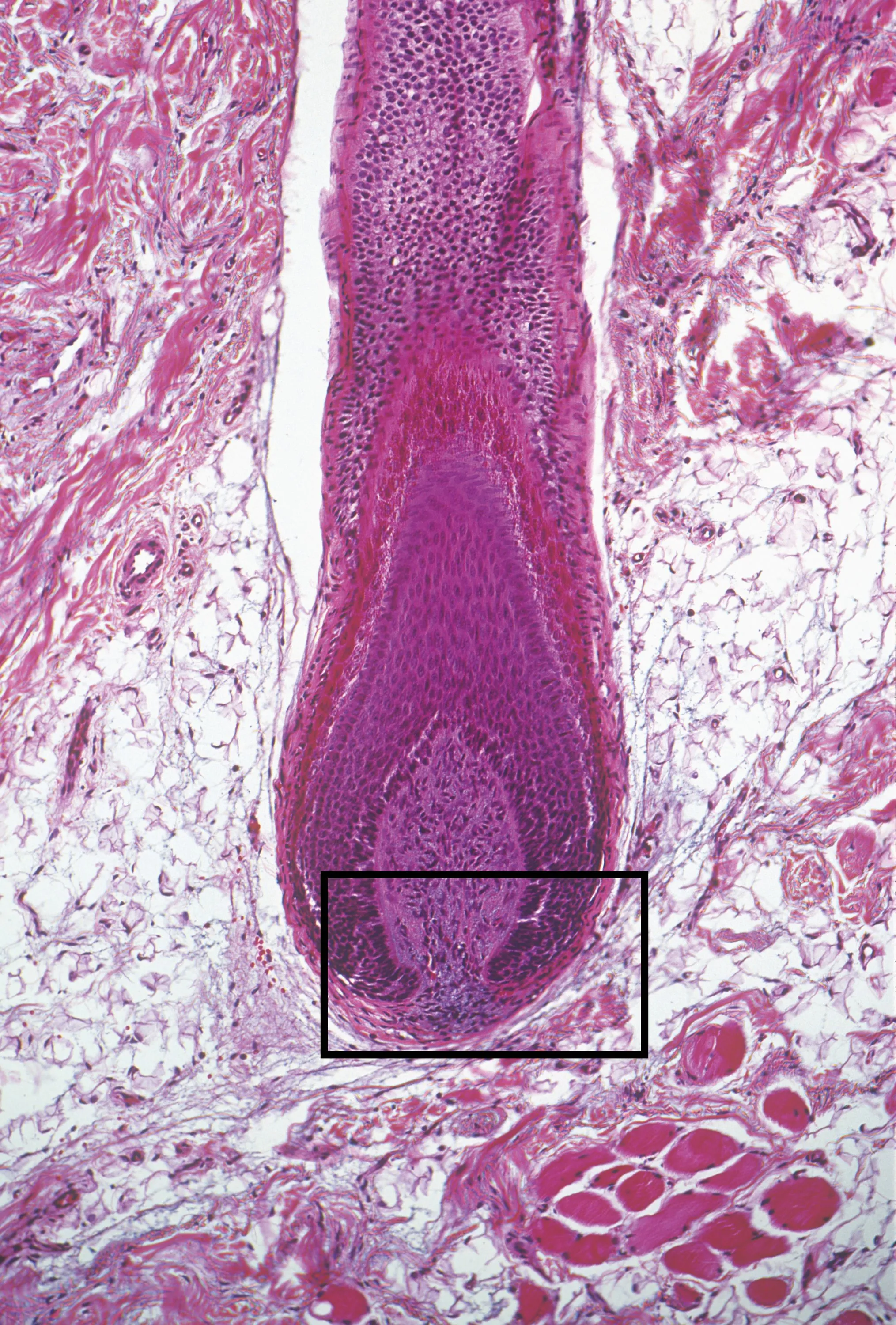 Base d'un cheveu observée au
microscope (grossissement : X52).