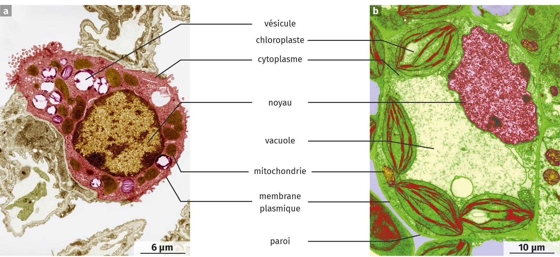 comparaison de type cellulaires