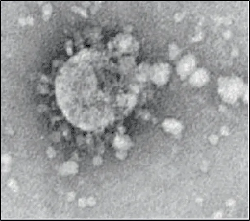 Micrographie électronique: virus SARS-CoV-2 sphérique. 
