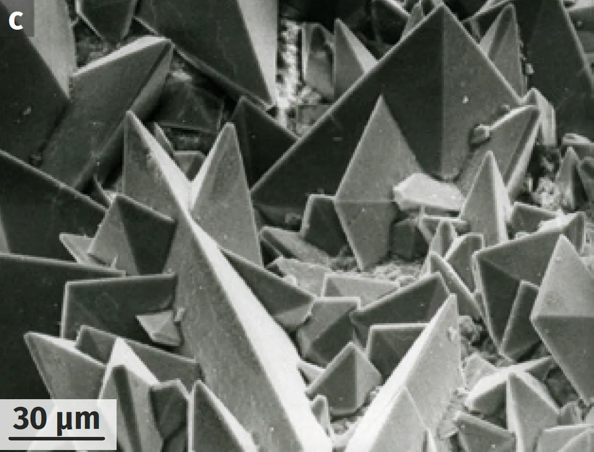 Surface d'un calcul composé d'oxalate de calcium CaC2O4 (microscopie électronique à balayage).