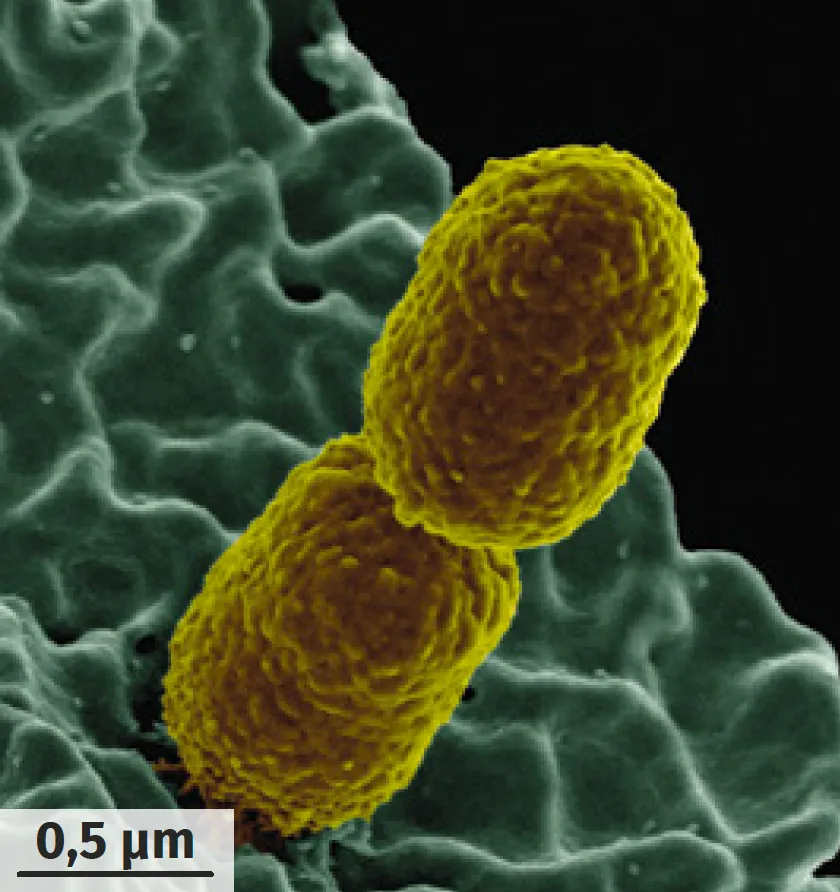 Klebsiella au microscopie électronique à
balayage