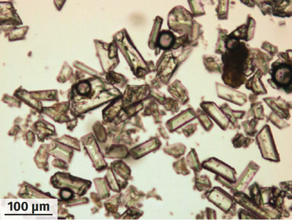 Cristaux de struvite au microscopie optique.