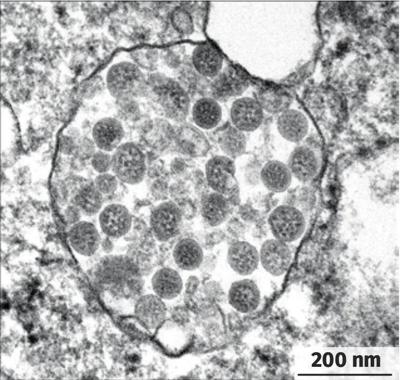 Un pneumocyte