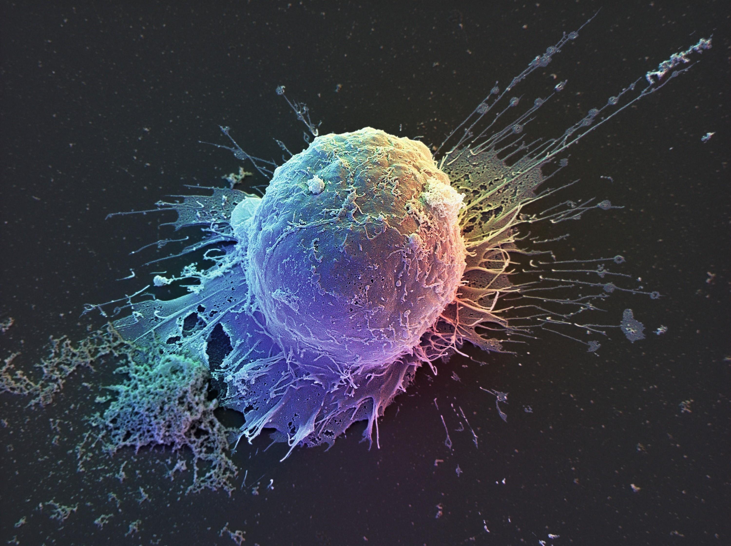 Cellule souche embryonnaire humaine observée au microscope électronique