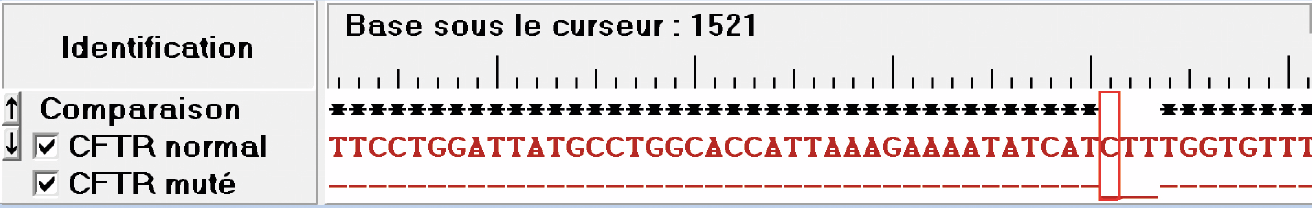 Comparaison des séquences du gène CFTR normal et muté