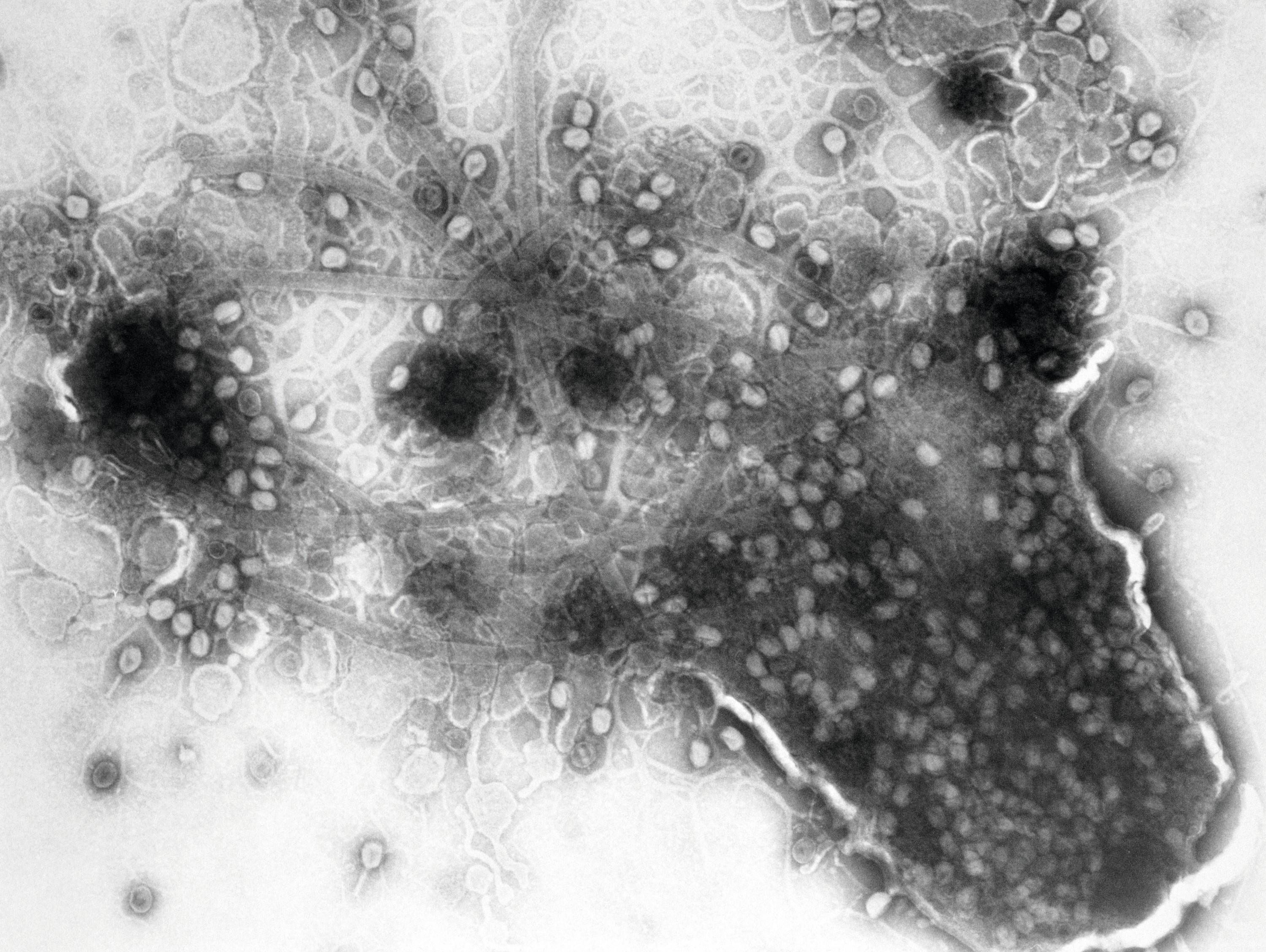 Распад кожи. Лизис клетки бактериофагом. Лизиса бактериальных клеток. Лизис бактериофага бактерий. Фаг т4 под микроскопом.